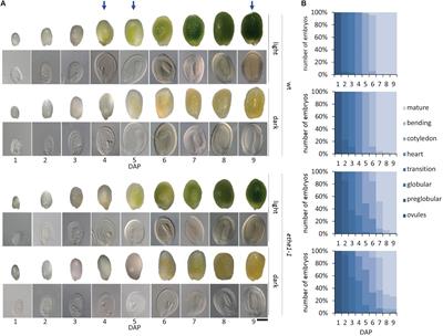 The Role of Persulfide Metabolism During Arabidopsis Seed Development Under Light and Dark Conditions